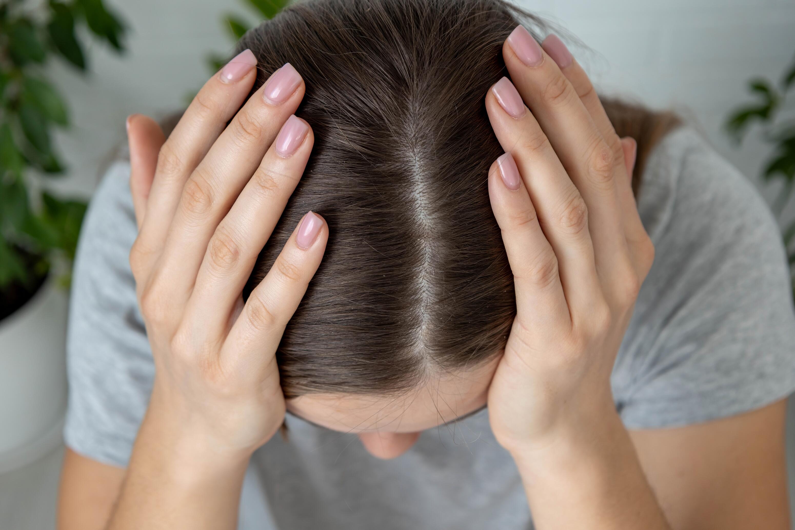 Cheveux qui tombent après un choc émotionnel